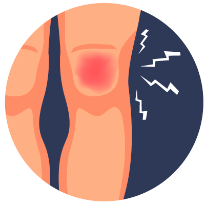 Me duele la rodilla ISLA Online
